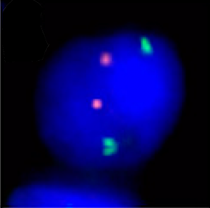 Analytics for FISH (Fluorescence In Situ Hybridization ) images