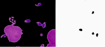 Leishamanasis and spectral imaging